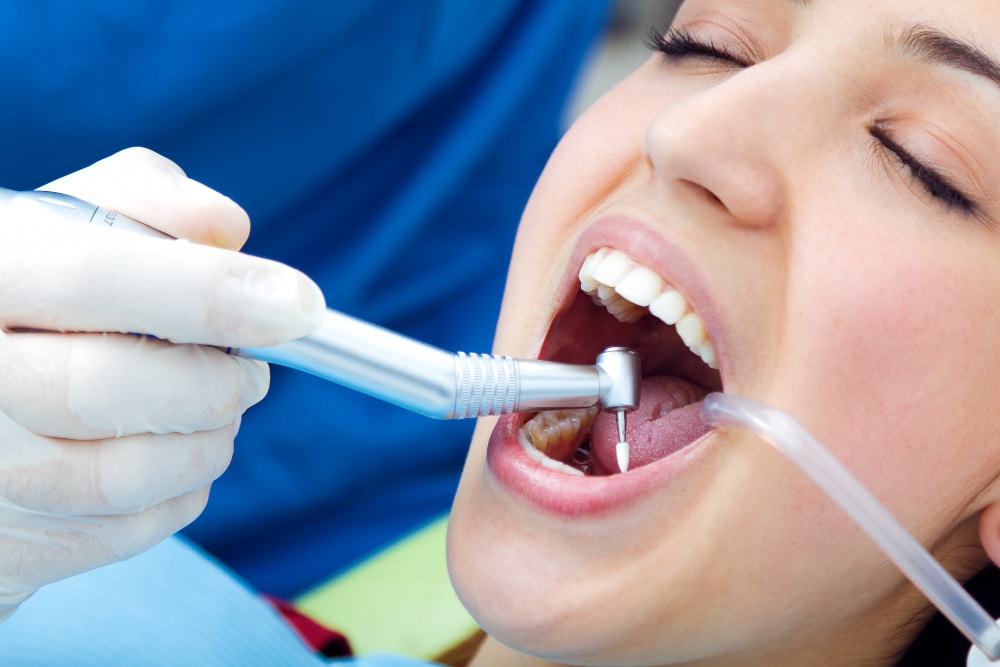 Dental professional cleaning a patient’s teeth with a powered instrument