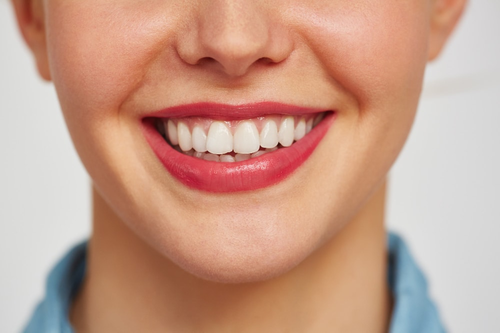 Woman displaying a bright smile for cosmetic dentistry and teeth whitening