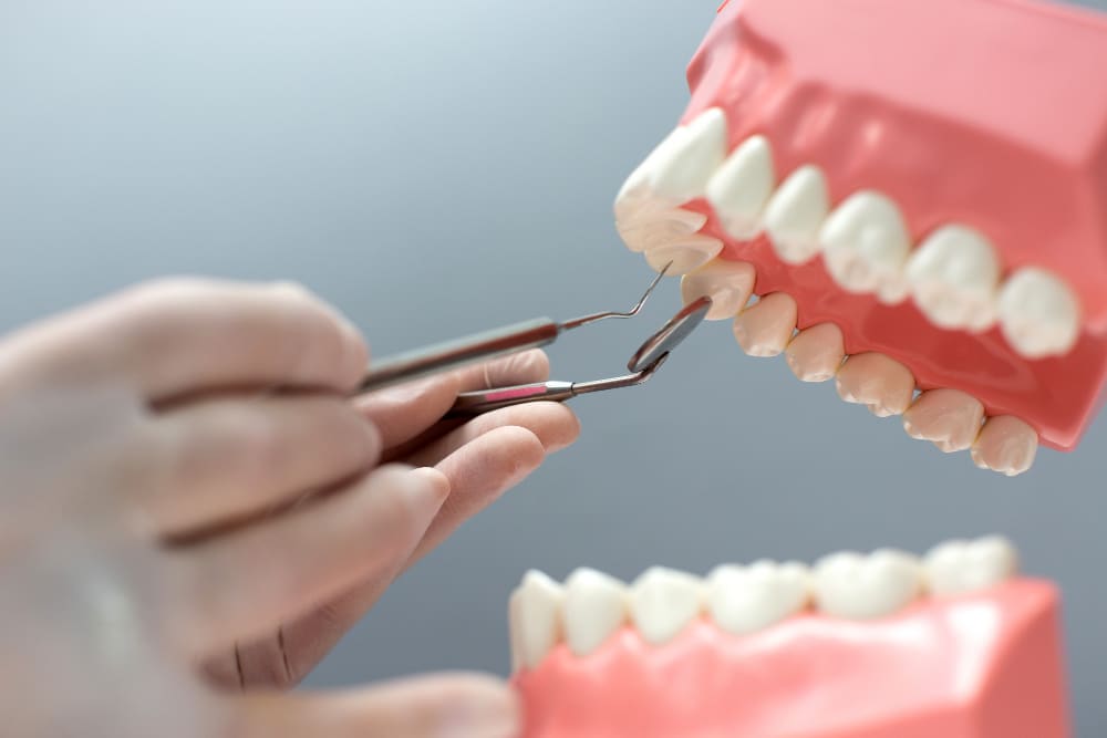 Dental professional demonstrating preventive dental care using a tooth model
