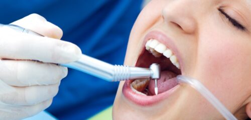 Dental professional cleaning a patient’s teeth with a powered instrument
